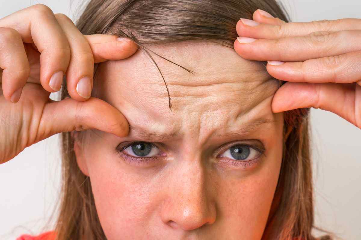 Las arrugas, sus causas y cómo prevenirlas