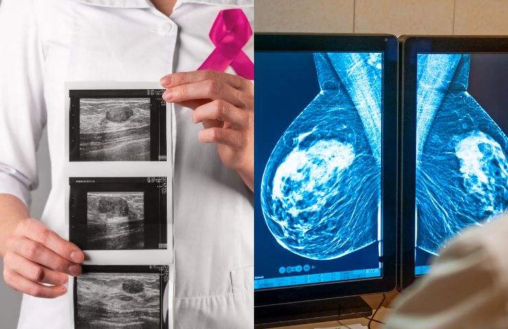 ecografía mamografía salud mujer pruebas médicas