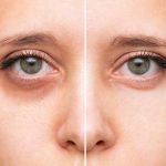 trucos eliminar ojeras maquillaje