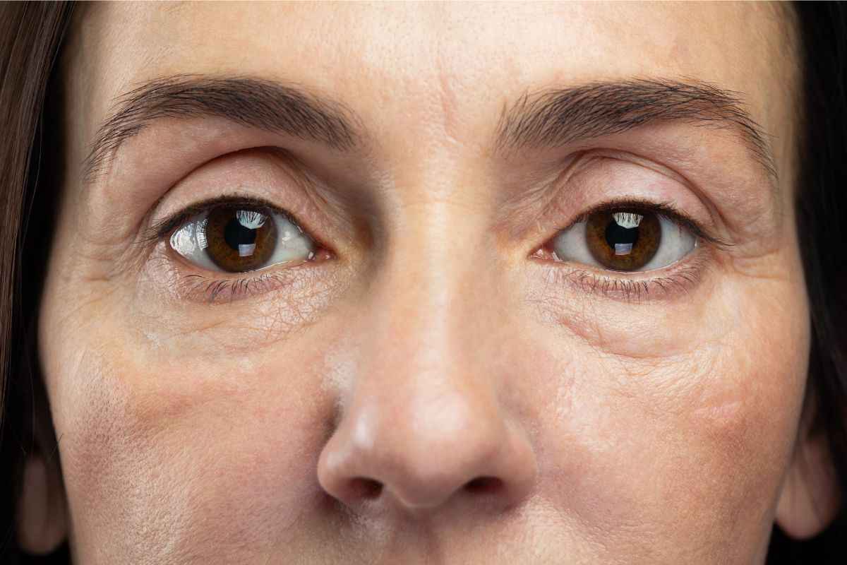 rostro marcas muraki mujer belleza bienestar salud