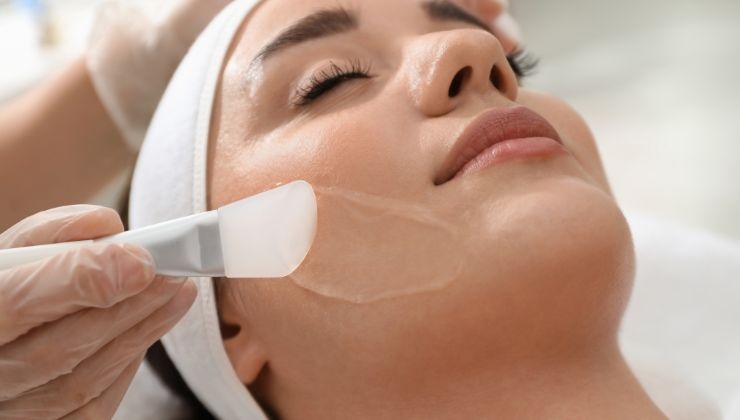 Un peeling puede necesitar varias sesiones